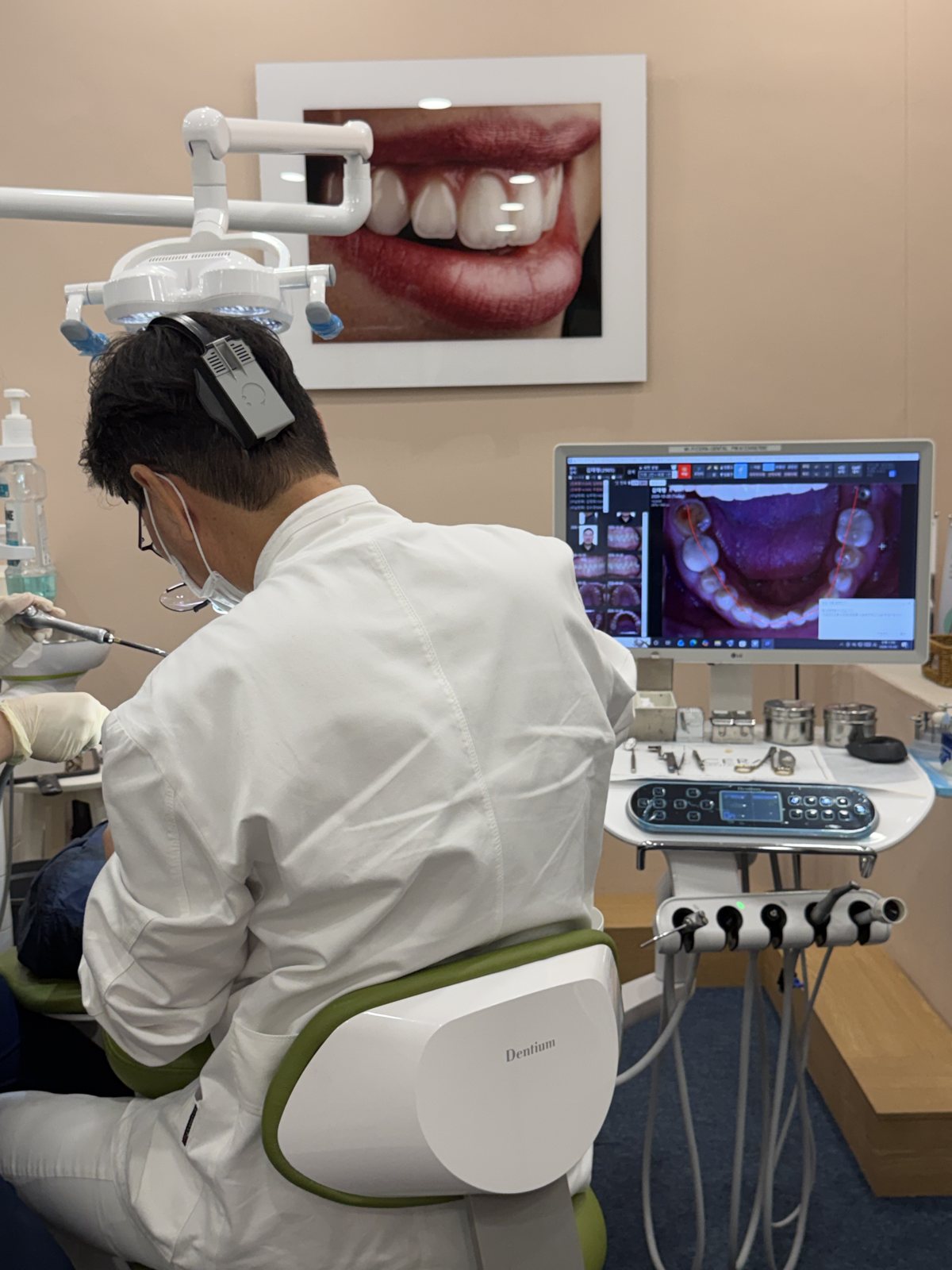 Ceramel laminate veneers at CERA Dental Clinic